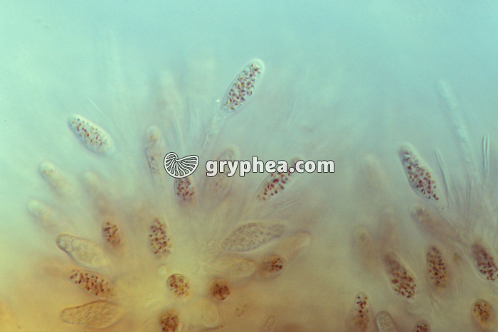 Fucus vésiculeux - anthéridies x70 - gryphea.org